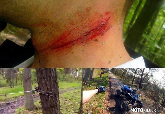 Pułapki na motocyklistów i quadowców – Kilka lat temu w Polsce było głośno o linkach rozwieszonych w lesie, które miały być swoistymi pułapkami na motocyklistów, którzy jeżdżą offroadówkami. To powoli przestawało być tylko szokujące, ale zaczynało być naprawdę niebezpieczne. Sprawa skomplikowała się, kiedy w końcu jeden z nich w ten sposób stracił życie.
Myślicie, że to przeszłość? Nic bardziej mylnego!
Tym razem są to linki stalowe, podwójne, nawet przykryte błotem i zakamuflowane, aby nie można było ich dostrzec. Ktoś po prostu robi sobie polowanie na motocyklistów i quadowców. Zdjęcie poszarpanej szyi należy do jednego z jeźdźców, który w tym tygodniu załapał się na takową niespodziankę i o mało nie przypłacił tym swoim życiem. Uważajcie na siebie 